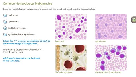 Understanding Common Hematological Malignancies-A.D.A.M. OnDemand