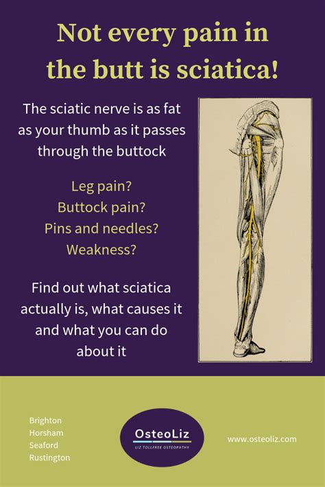 Pin on Sciatica and trapped nerves