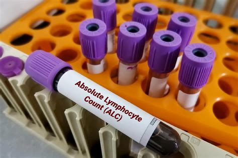 Absolute Lymphocyte Count Test: Normal Range, Purpose, Preparation