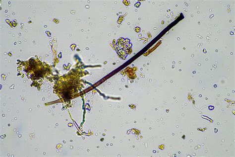 Soil Sample Under the Microscope. Soil Fungi and Microorganisms Cycling ...