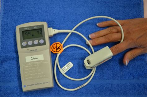 5.3 Pulse Oximetry – Clinical Procedures for Safer Patient Care