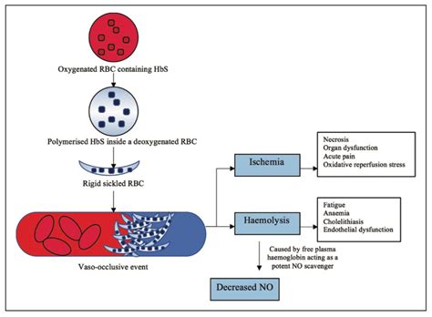 Turning Back the Sickle Cell Disease: A New Drug into Play | Drug can ...