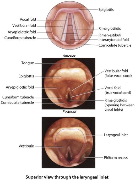 Laryngoscopy - Procedures Consult