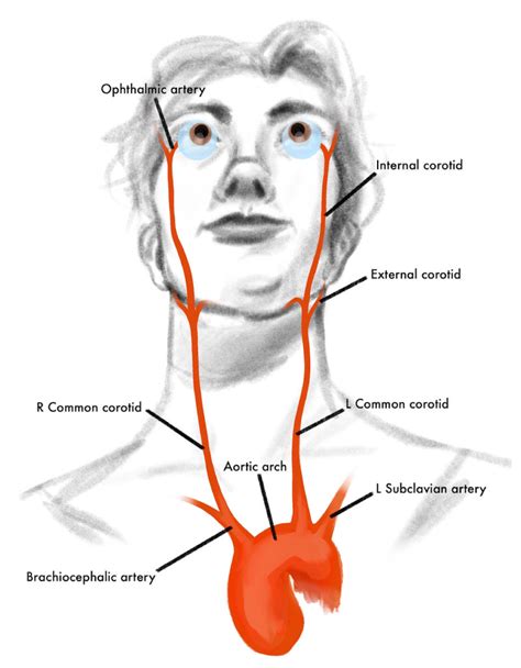 EyeRounds.org: Ocular Ischemic Syndrome