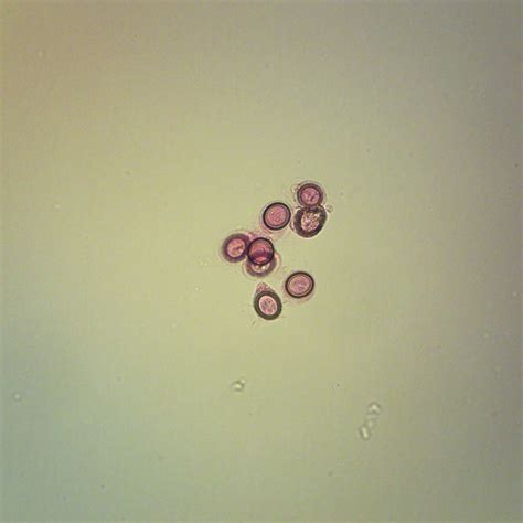 Echinococcus Granulosus Eggs, W.M. Microscope Slide - Walmart.com