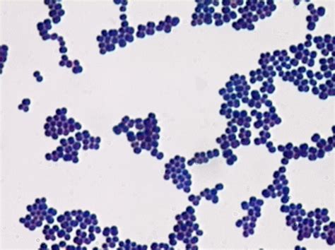 Gram Staining Rules