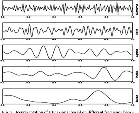 Normal Versus Abnormal Eeg