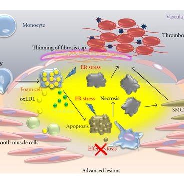 Cellular interactions with macrophages in an advanced lesion. Foam ...