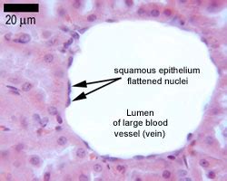 Simple Squamous Epithelium, Chapter 1 Page 7 Histologyolm - This type ...