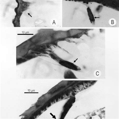 -A: scanning electron micrograph view of a Triatoma infestans fifth ...