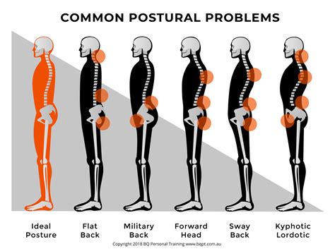 Poor Posture - BQ Personal Training