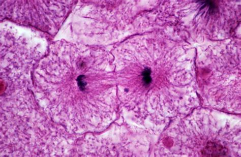 Middle telophase of mitosis, LM - Stock Image - P673/0079 - Science ...