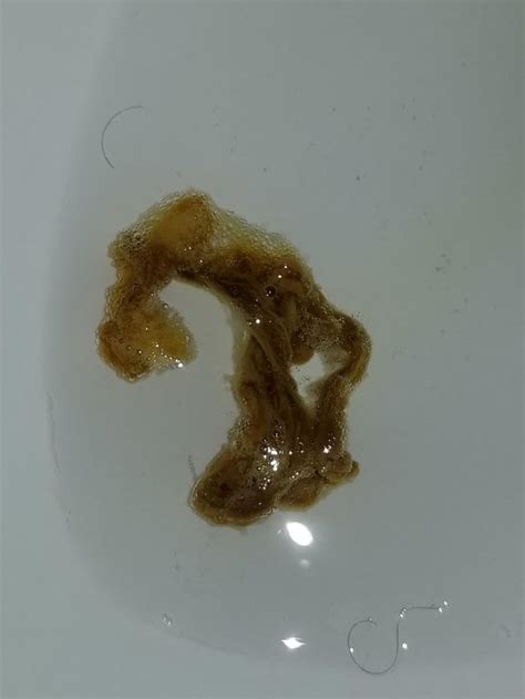 is this a parasite in my stool? should I be worried. any help would be ...