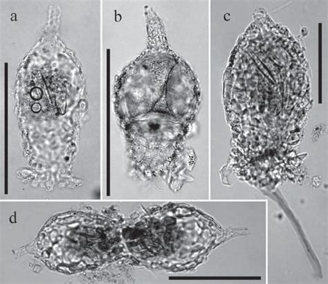 Different specimens of Difflugia elegans (a, b, d) and Difflugia ...