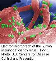 Nail fungus drug might help against HIV, study suggests