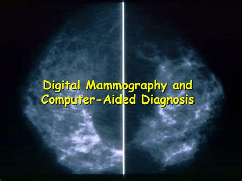 Digital Mammography