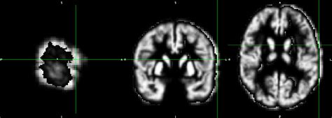 Downsample Image - mri - Neurostars