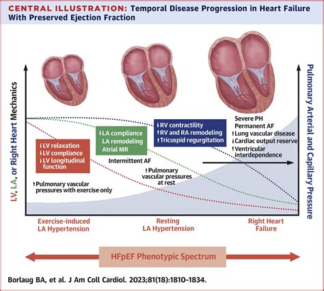 Ejection Fraction Use In Heart Failure at Vincent Strand blog