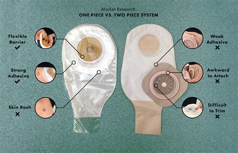 Ileostomy Vs Colostomy Colostomy Ileostomy Ostomy