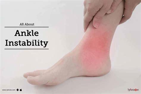 All About Ankle Instability - By Dr. P. Sharat Kumar | Lybrate