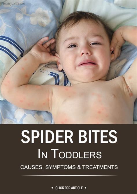 Spider Bites In Toddlers: Facts, Symptoms & Ways To Prevent | Dairy ...