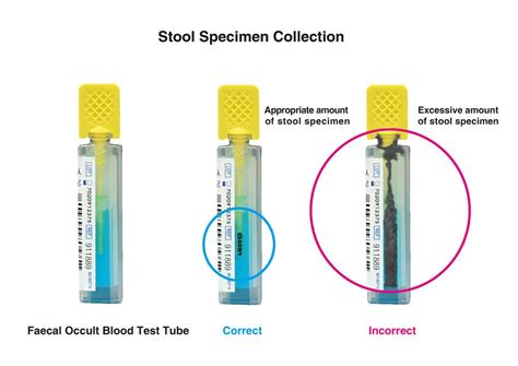 How to collect stool specimen | Prevent Colorectal Cancer