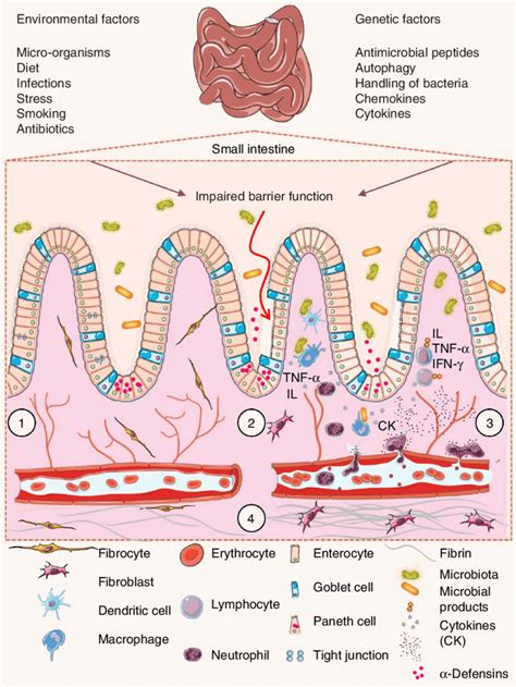 Pathophysiology of inflammatory bowel disease. (1) The villi and ...