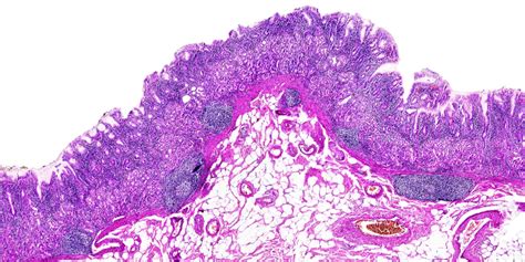 A Beginner's Guide to Haematoxylin and Eosin Staining