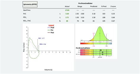 Spirometry Normal Values Chart