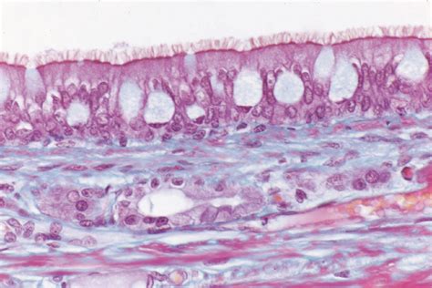 Pseudostratified Columnar Epithelium Histology Histology Slides ...