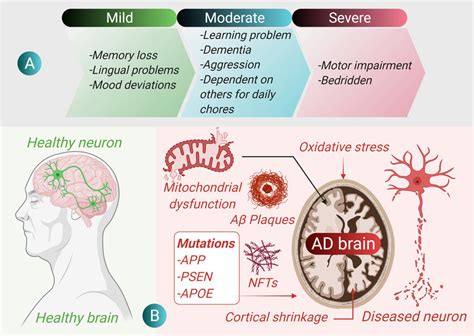 Alzheimer disease and its pathogenesis. (A) Characteristic symptoms at ...