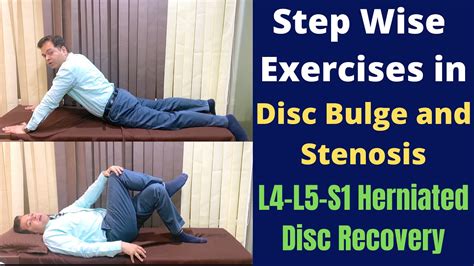 Exercises For Herniated Disc, Disc Bulge L4-L5-S1, Step Wise Treatment ...