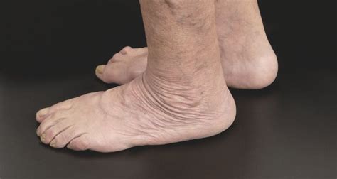 Aging Feet Changes And Problems FAQ | UgleeFeet