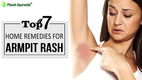 Top 7 Home Remedies for Armpit Rash