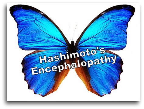 If you have Hashimoto's, you may want to become aware of Hashimoto's ...