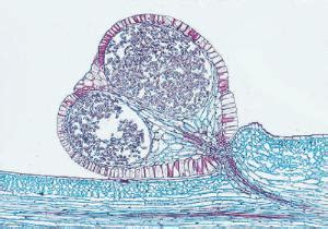 Psilotum, Stem & Sporangia Slide | Ward's Science