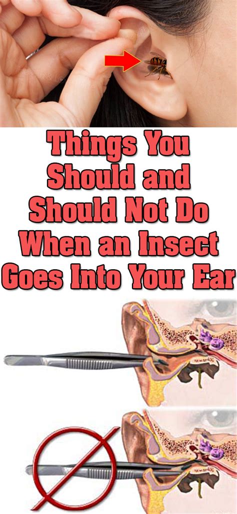 Insect In Ear Removal