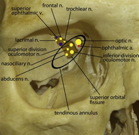 Syndromes Affecting the Central Nervous System - Atlas of the Oral and ...