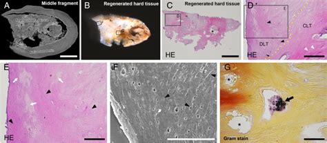 Histologic and Electron Microscopic Characterization of a Human ...