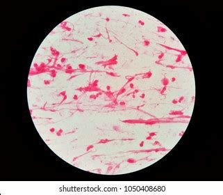 This Sputum Gram Stain Shown Numerous Stock Photo (Edit Now) 1050408680