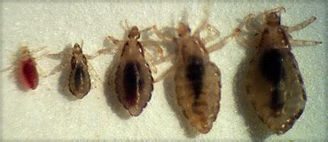 How To Recognize Lice | Lice Removal and Treatment | Ladibugs Clinic