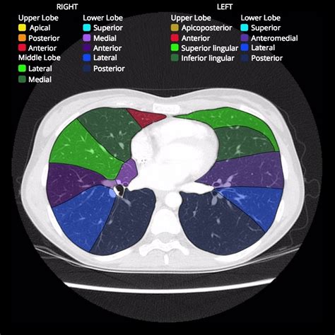 Ct Thorax Anatomy - Anatomy Reading Source