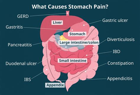 Abdominal Pain: When Should I See a Healthcare Provider?