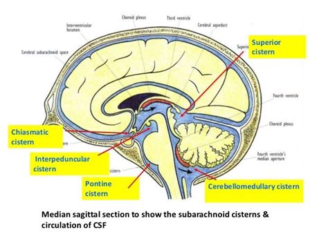 Arachnoid cisterns Cranial Anatomy, Cerebrospinal Fluid, Radiology ...