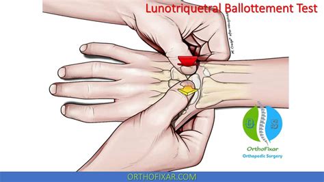 Lunotriquetral Ballottement Test • Easy Explained | OrthoFixar