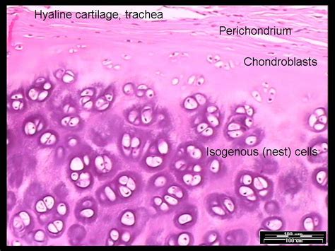 hyaline cartilage | Hyaline cartilage, Cartilage, Human tissue