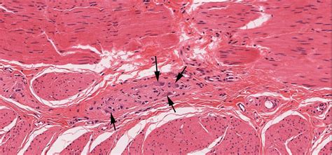 Peripheral Nervous System | histology