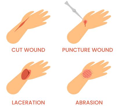 Learn about Lacerations | MCR Safety Info Blog