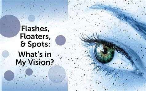 Flashes, Floaters, and Spots | What is in my Vision?