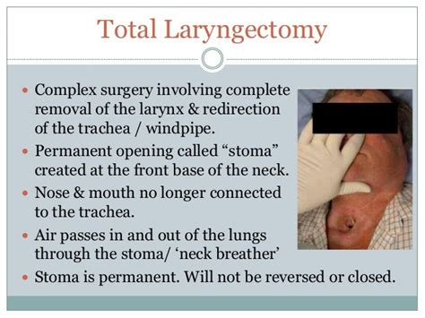 The laryngectomy patient